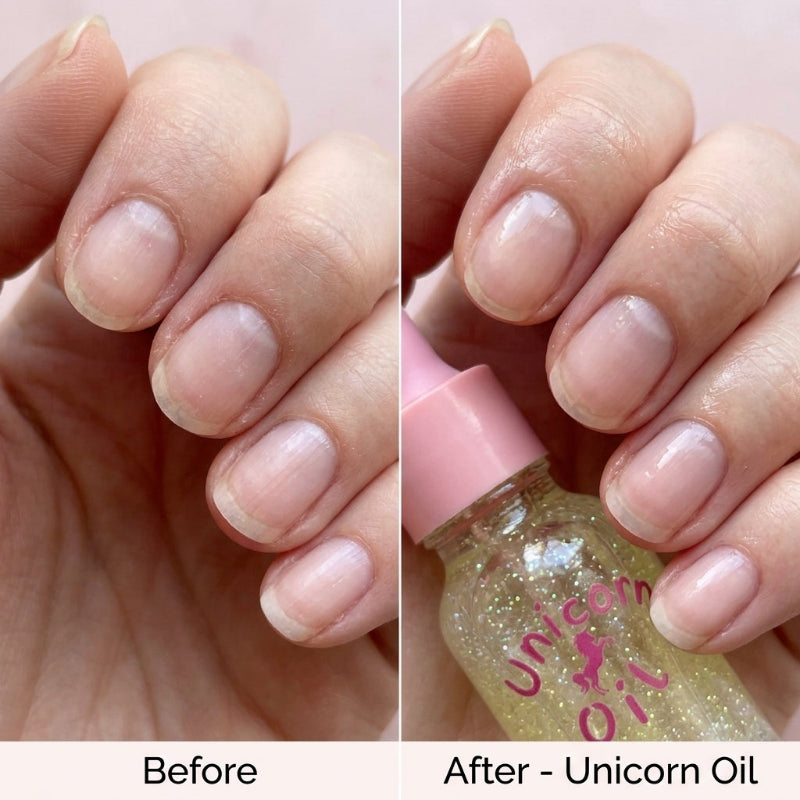 Cuticle Oil for Dry Nails
